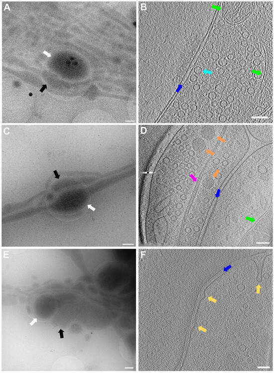 A high magnification image of synapse obtained by electron microscopy