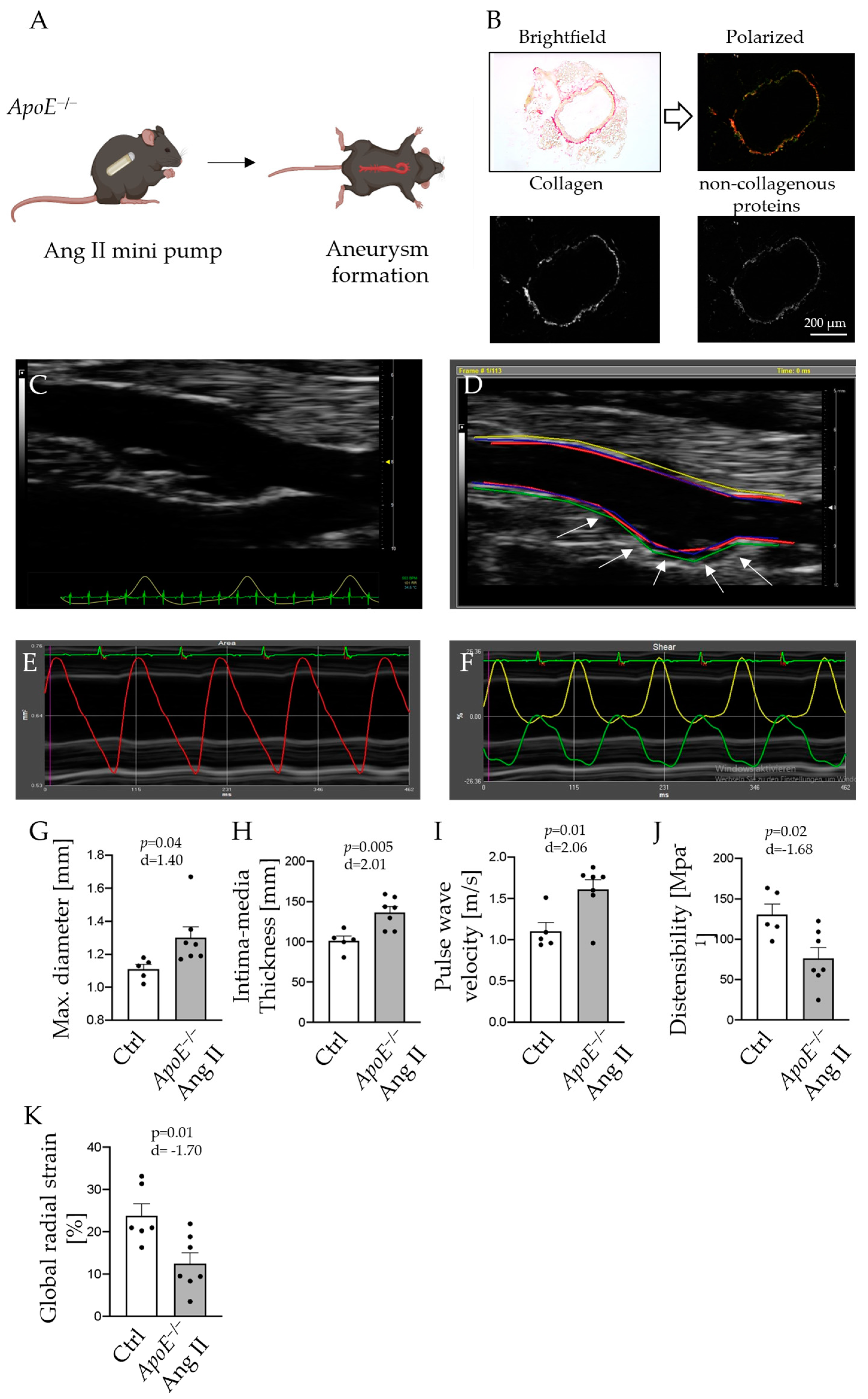 IJMS | Free Full-Text | Vascular Ultrasound For In Vivo Assessment.