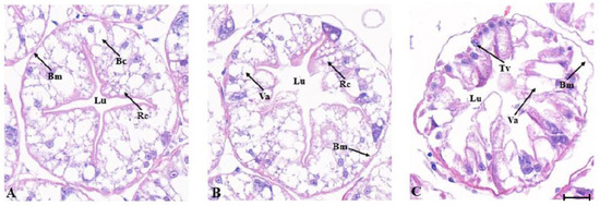 Regulation Mechanism of Dopamine Receptor 1 in Low