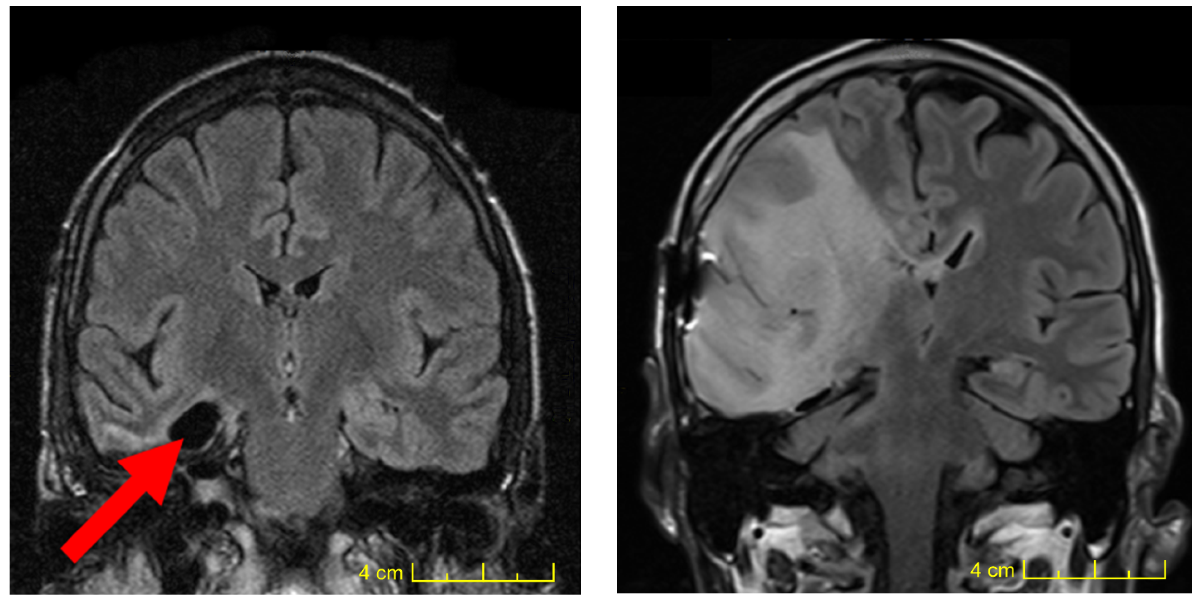 Ijms 24 15701 g004 Ijms 24 15701 g004