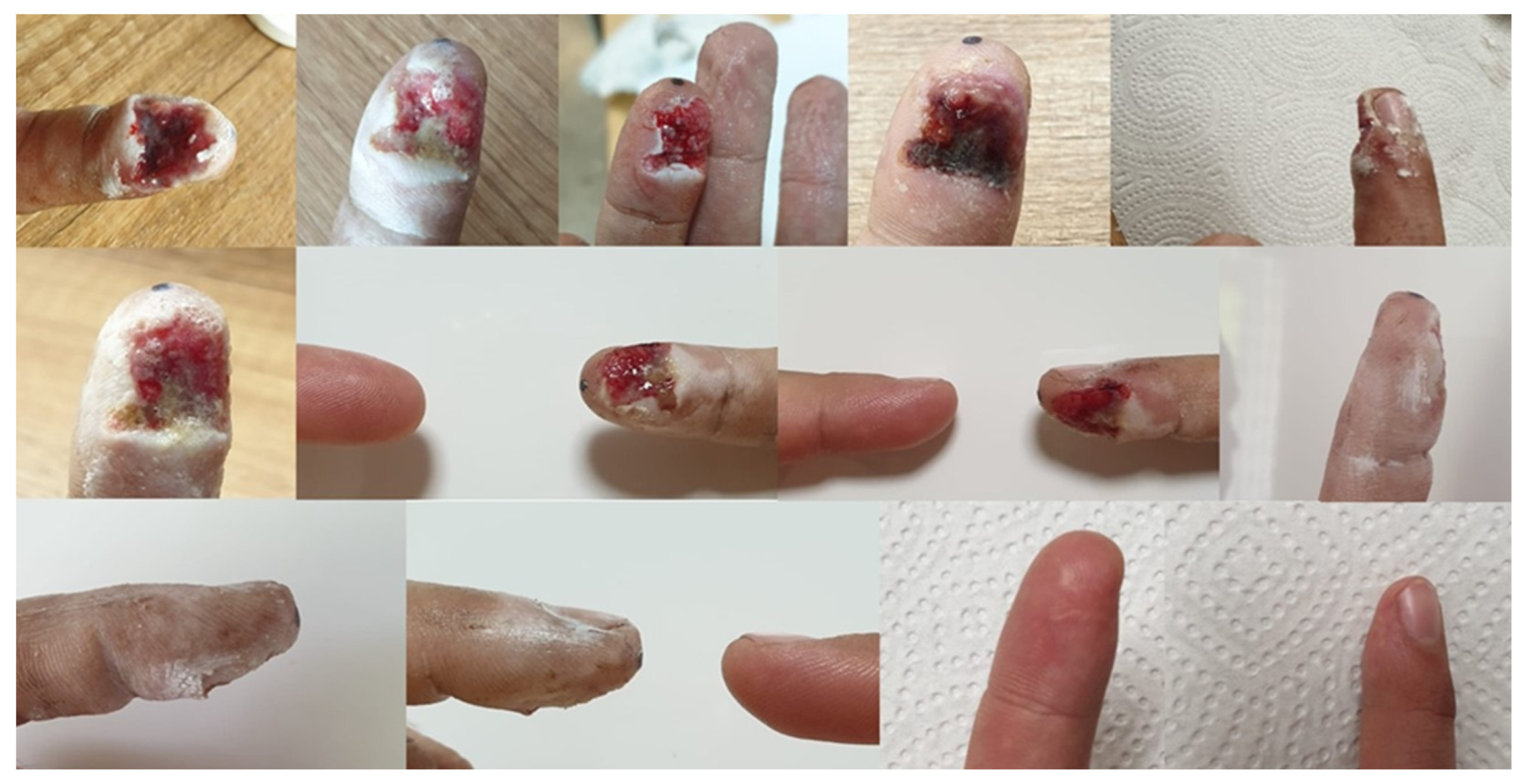 Ijms 24 15723 g007 Ijms 24 15723 g007