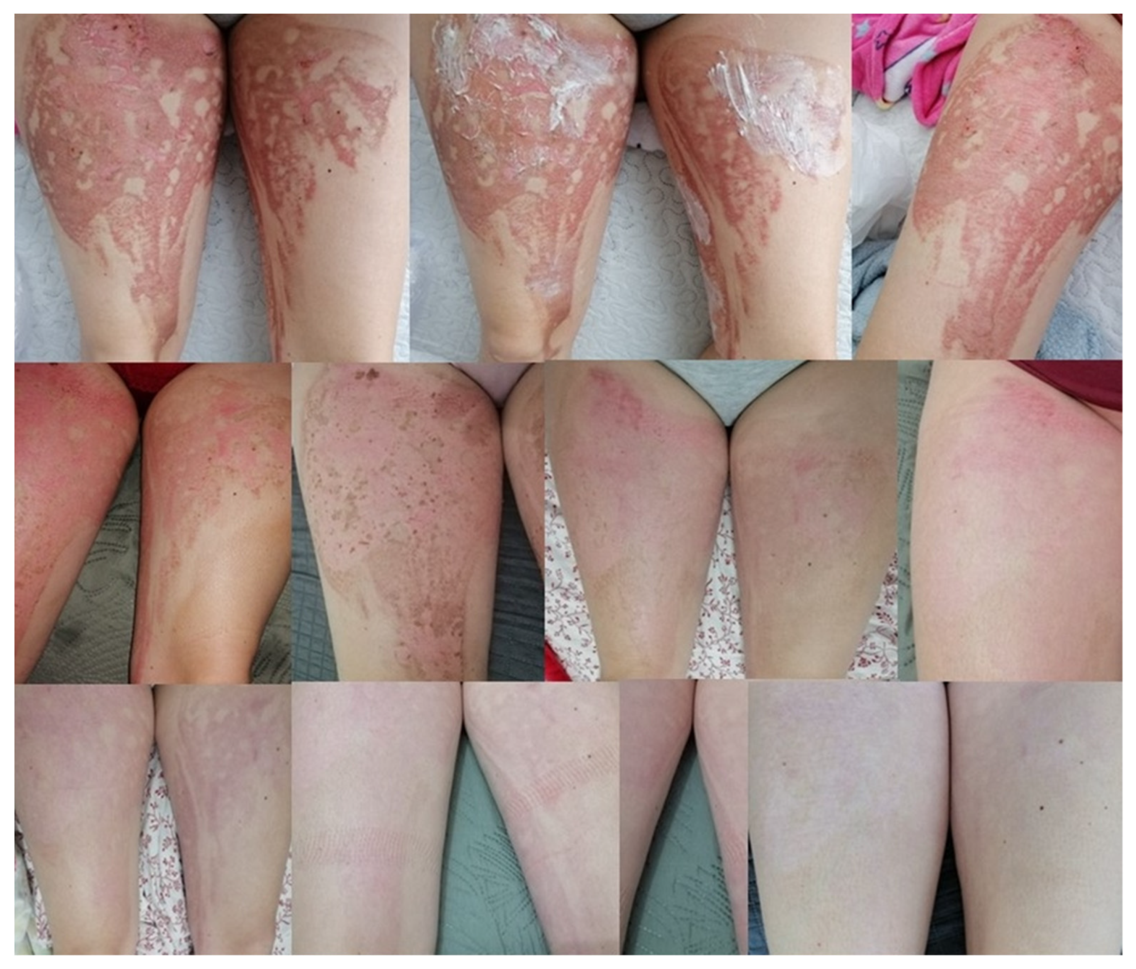 Ijms 24 15723 g008 Ijms 24 15723 g008