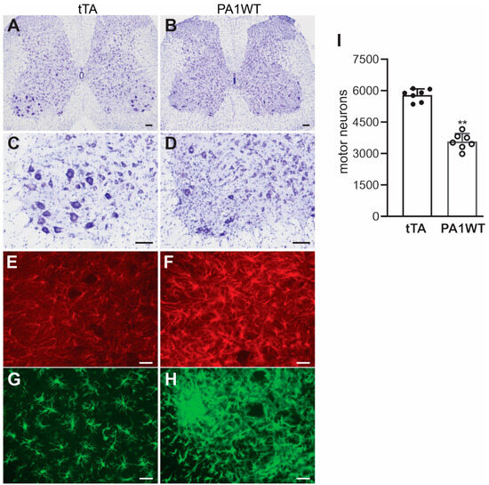 Increase in hnRNPA1 Expression Suffices to Kill Motor Neurons in ...
