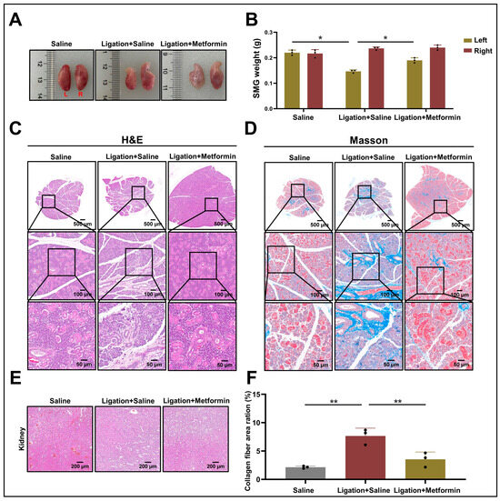 Metformin Attenuates TGF-β1-Induced Fibrosis in Salivary