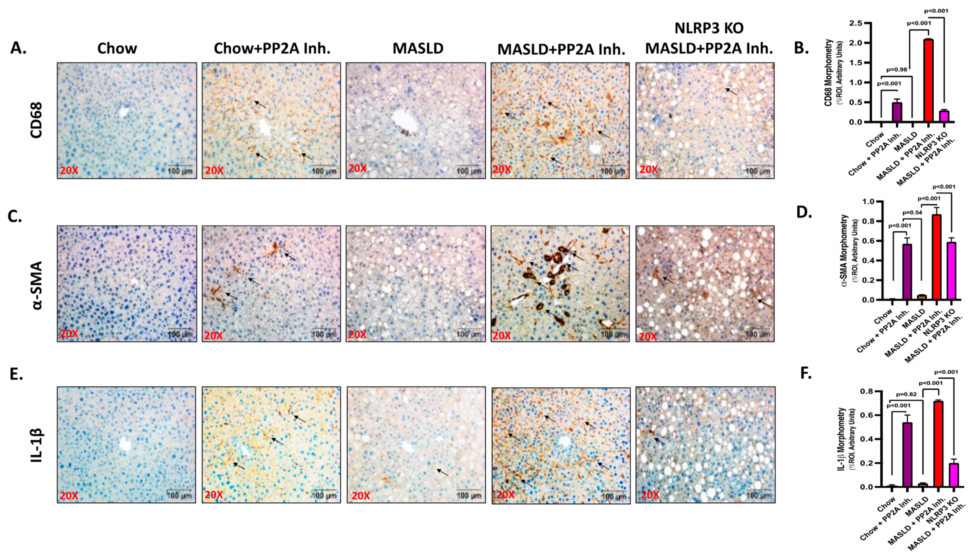Hepatic NLRP3-Derived Hsp70 Binding to TLR4 Mediates MASLD Hepatic NLRP3-Derived Hsp70 Binding to TLR4 Mediates MASLD