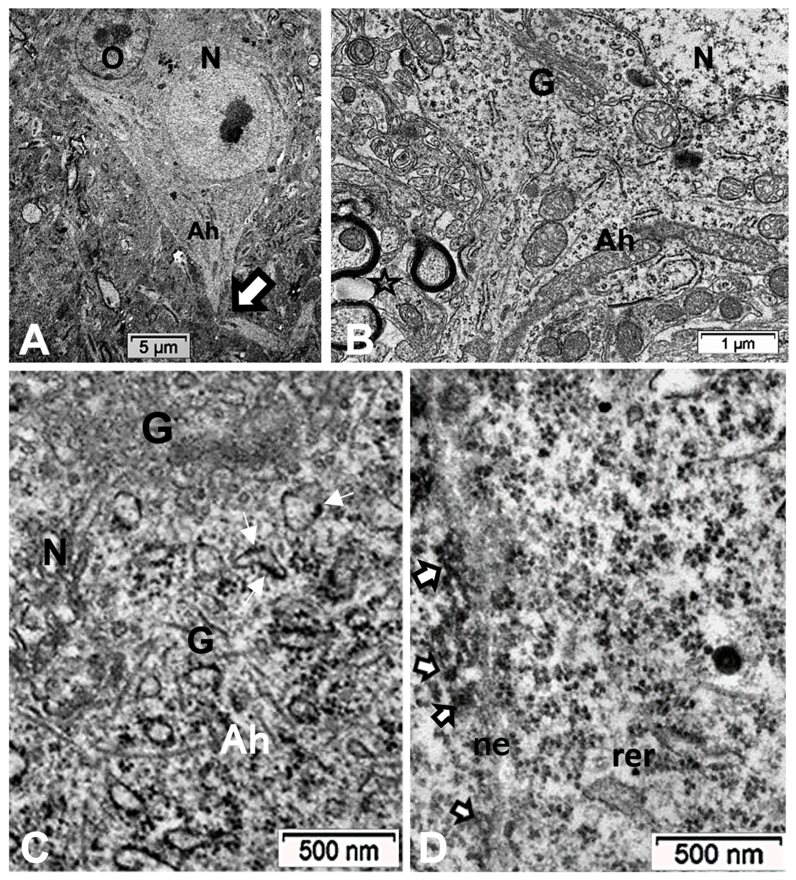 Ijms 24 16448 g011 Ijms 24 16448 g011