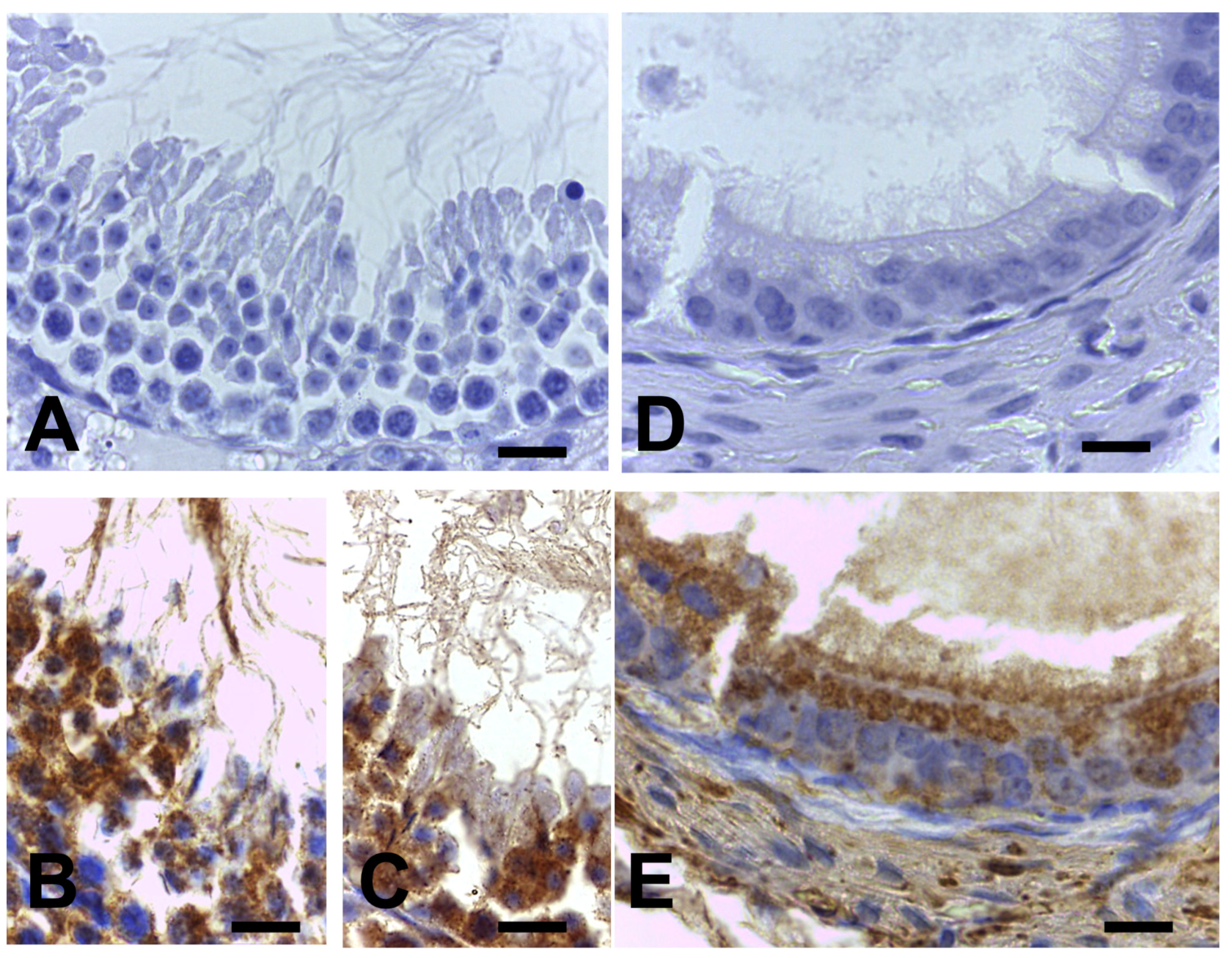 Ijms 24 16448 g0a1 Ijms 24 16448 g0a1