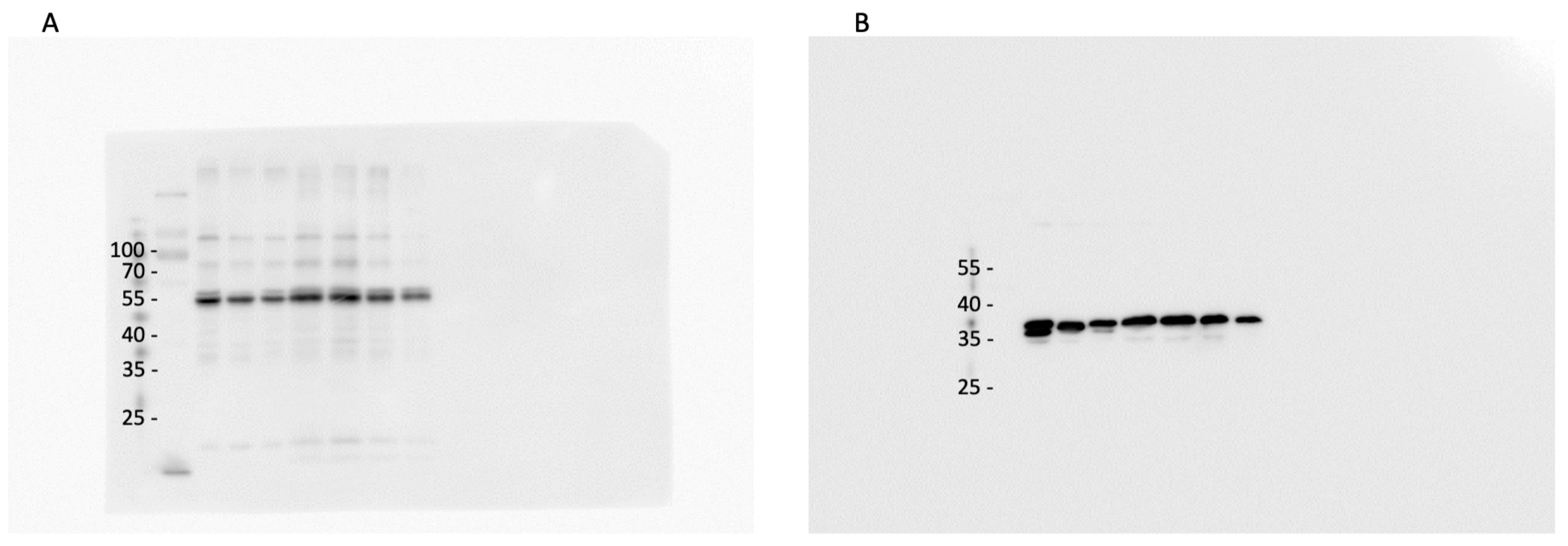 Ijms 24 16448 g0a3 Ijms 24 16448 g0a3