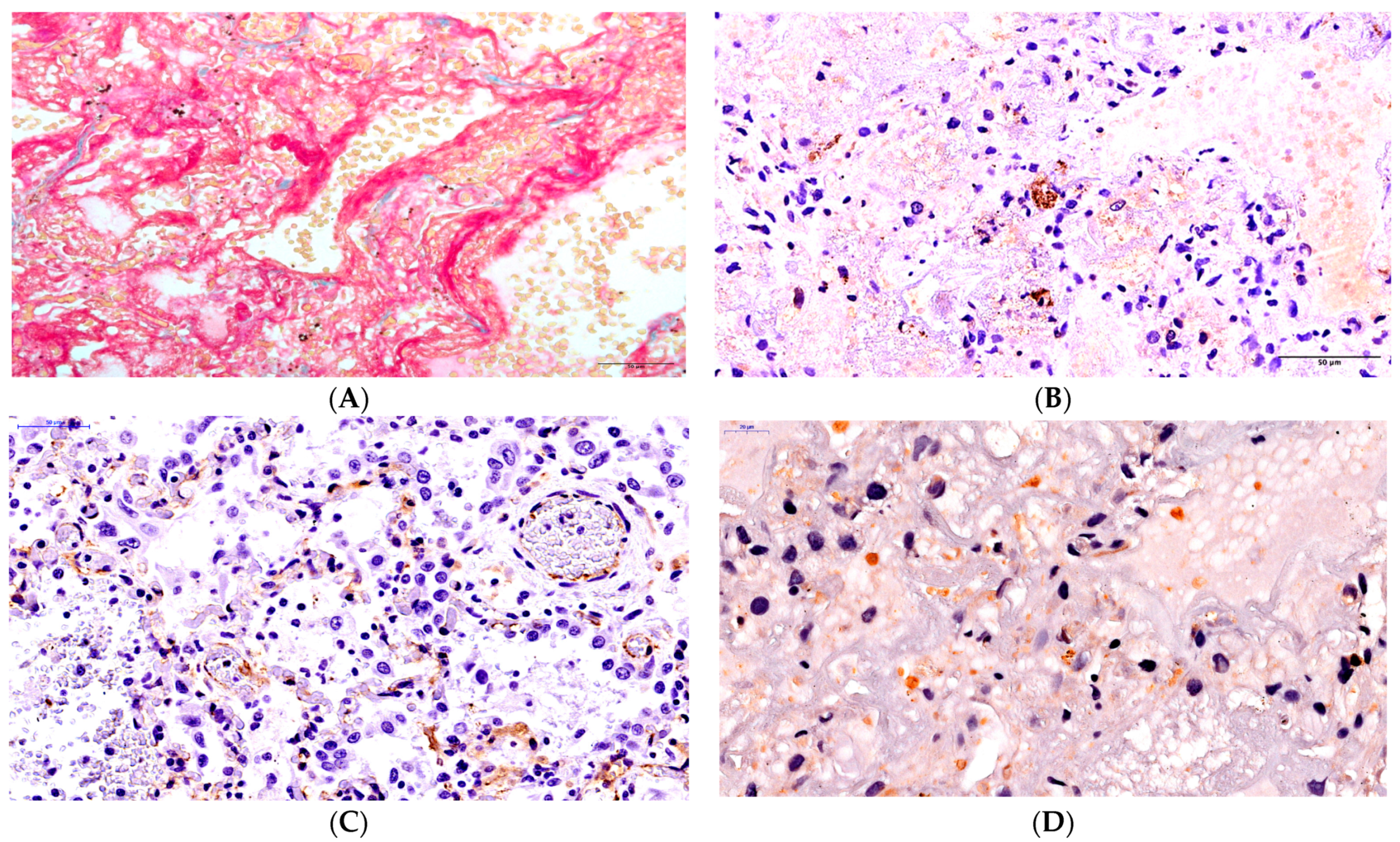 Ijms 24 16750 g003 Ijms 24 16750 g003