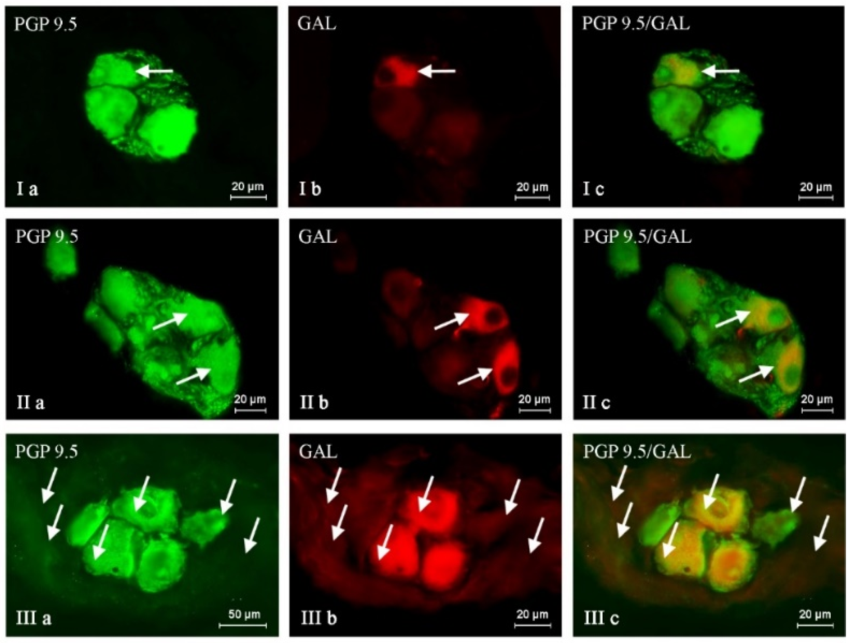 Bisphenol A Effects on Neurons’ Neurochemical Character in