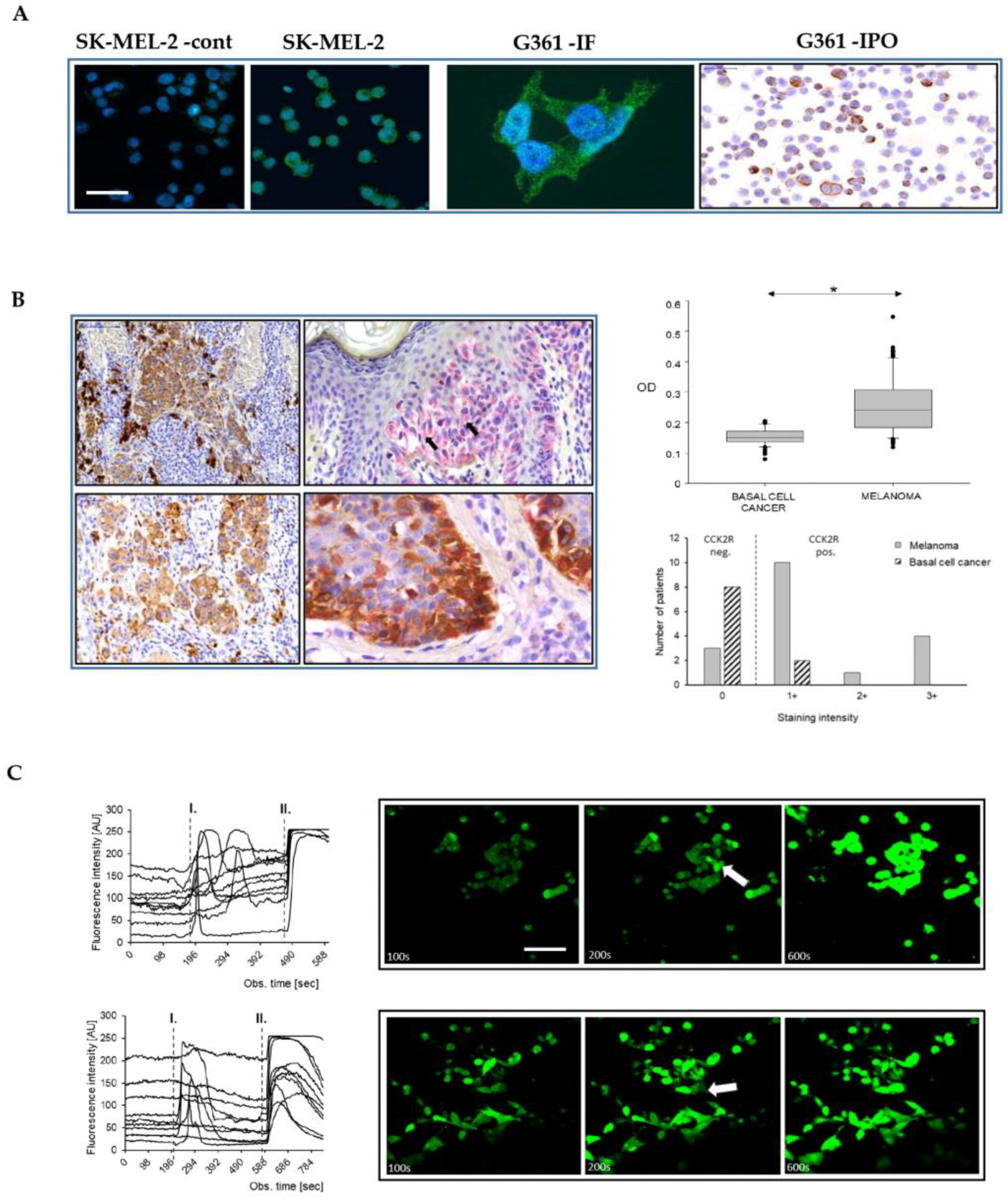 Elevated Serum Gastrin Is Associated with Melanoma Progression 