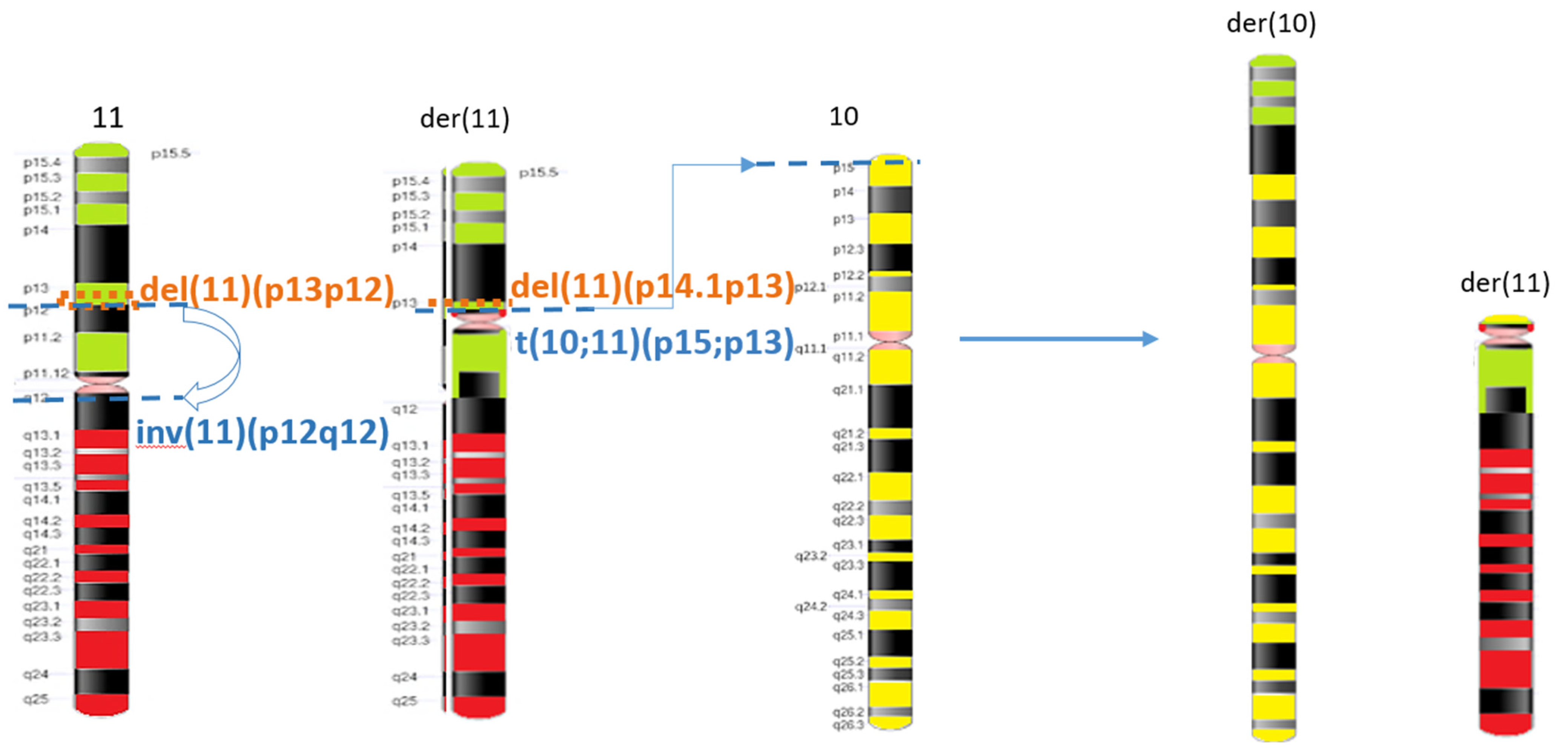 IJMS Free FullText Complex Chromosomal Rearrangement Involving