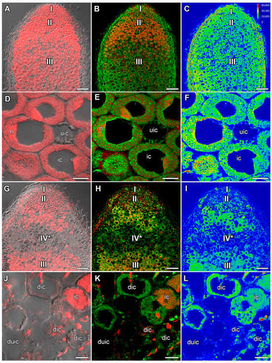 Effects of Elevated Temperature on Pisum sativum Nodule Development: II ...