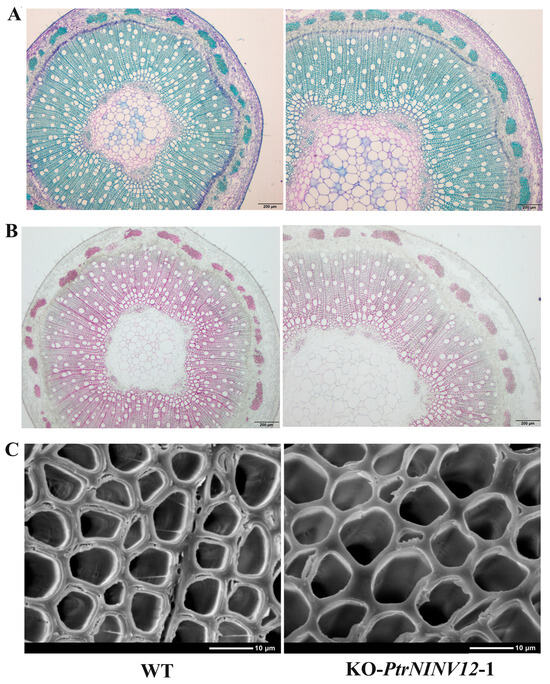 Structure and Expression Analysis of PtrSUS, PtrINV, PtrHXK