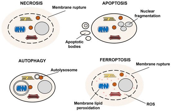 Ferroptosis, Metabolic Rewiring, and Endometrial Cancer