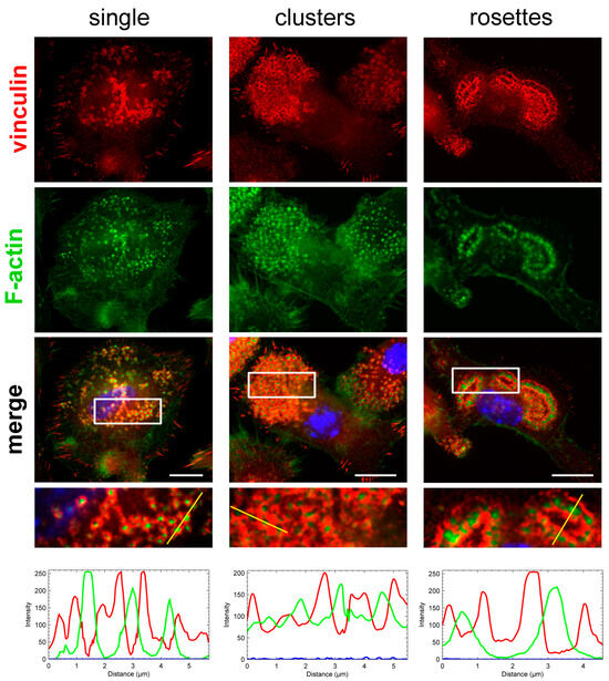 Ectromelia Virus Affects the Formation and Spatial Organization of ...