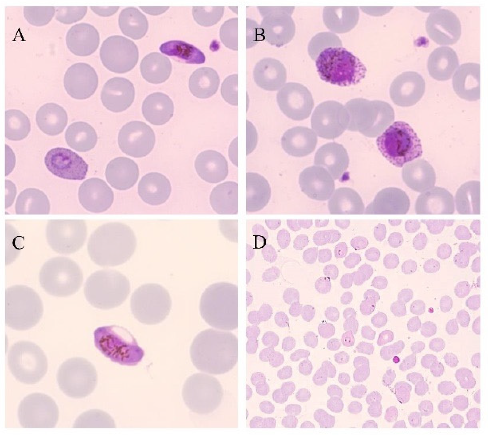 Malaria rapid diagnostic test