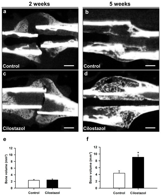 Cilostazol Stimulates Angiogenesis And Accelerates Fracture Healing In cilostazol-stimulates-angiogenesis-and-accelerates-fracture-healing-in