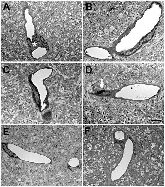 The Neurovascular Unit as a Locus of Injury in Low-Level