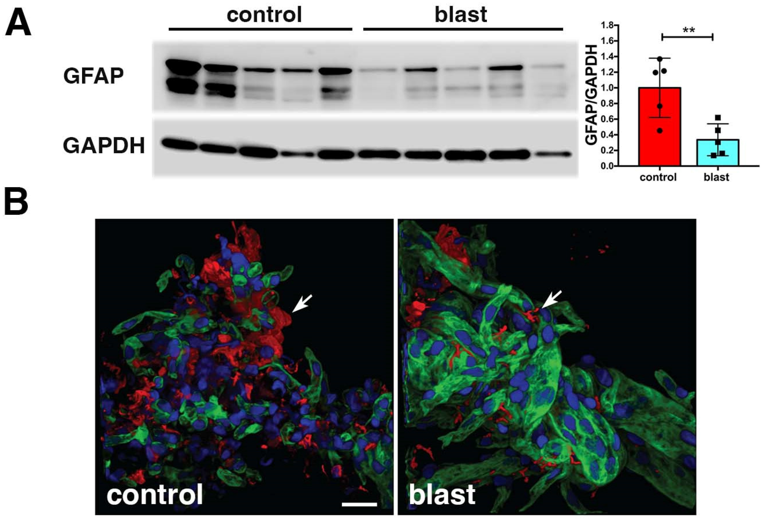 Ijms 25 01150 g003 Ijms 25 01150 g003