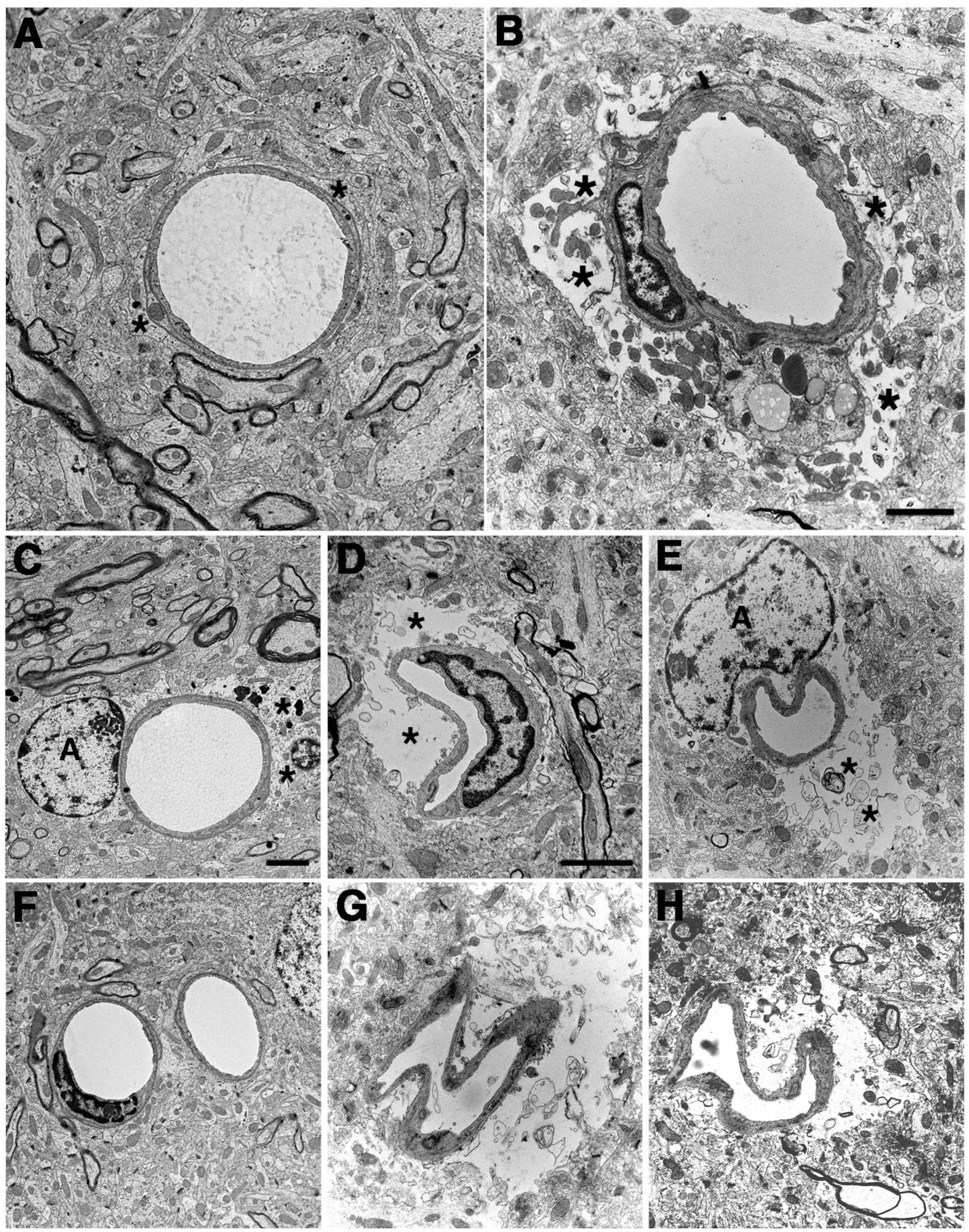 Ijms 25 01150 g004 Ijms 25 01150 g004