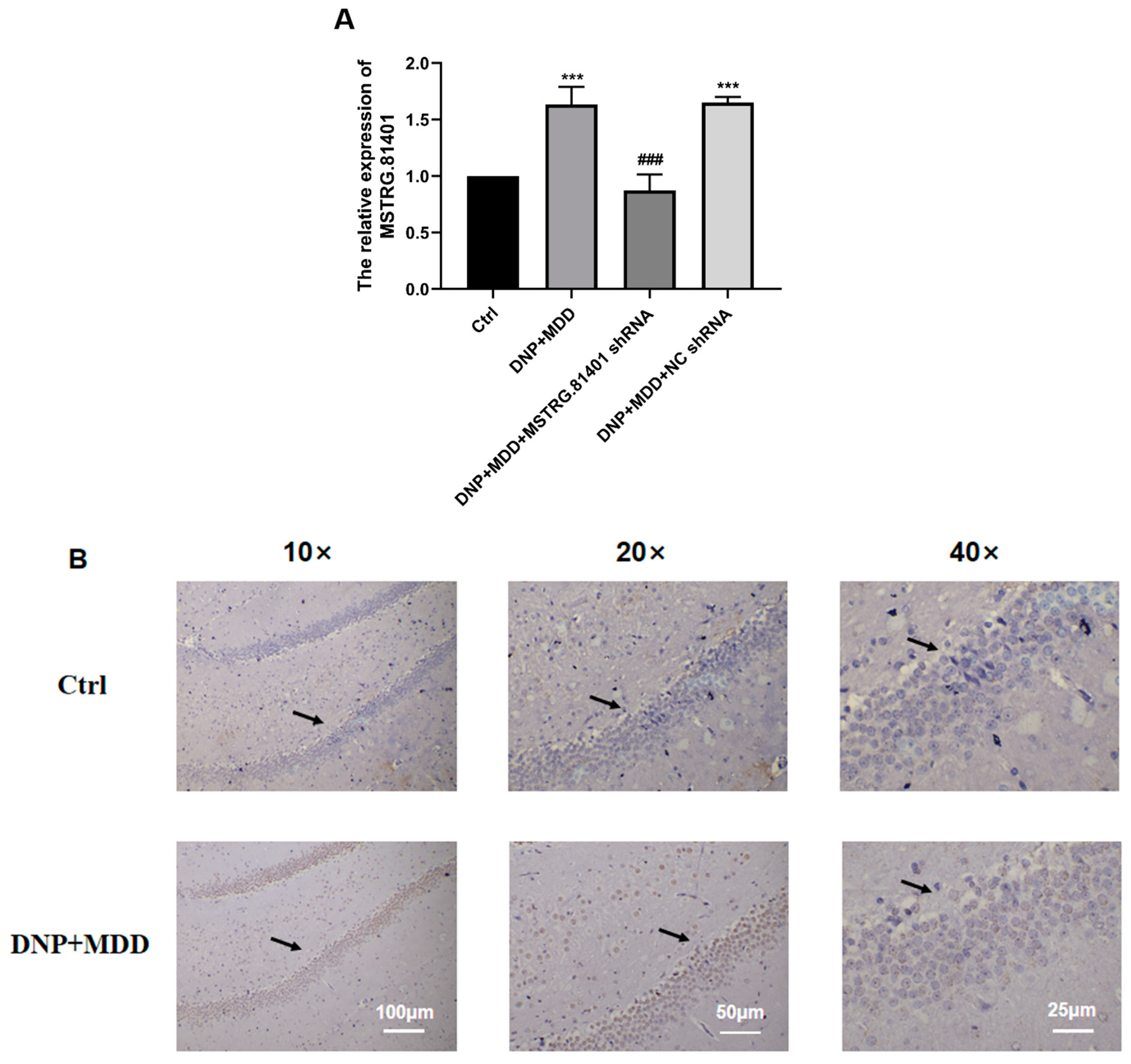 Ijms 25 01186 g003 Ijms 25 01186 g003