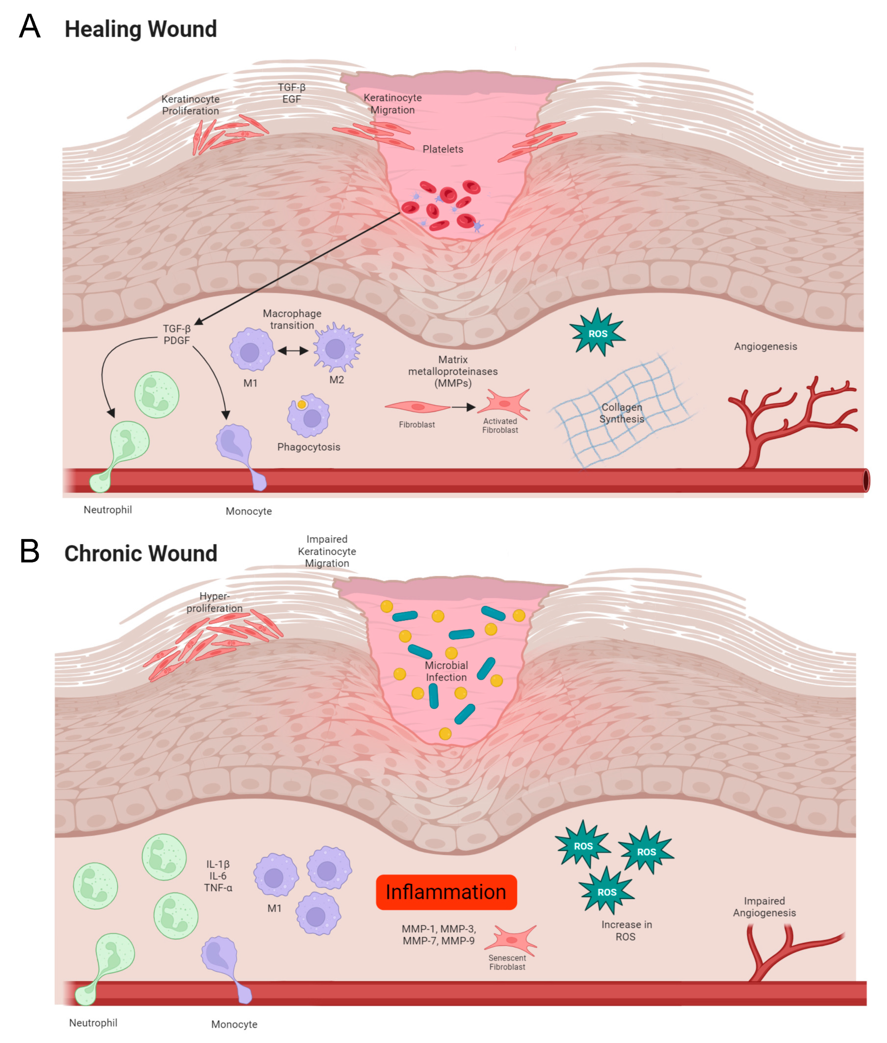 治癒の病理 = Pathology of Wound Healing 裁断済み Kick-Starting Wound Healing: A Review of Pro-Healing Drugs
