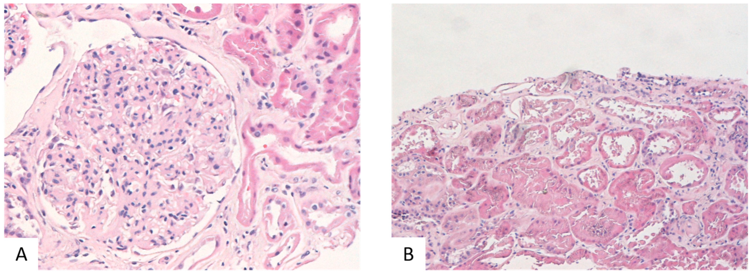 Ijms 25 01387 g003 Ijms 25 01387 g003