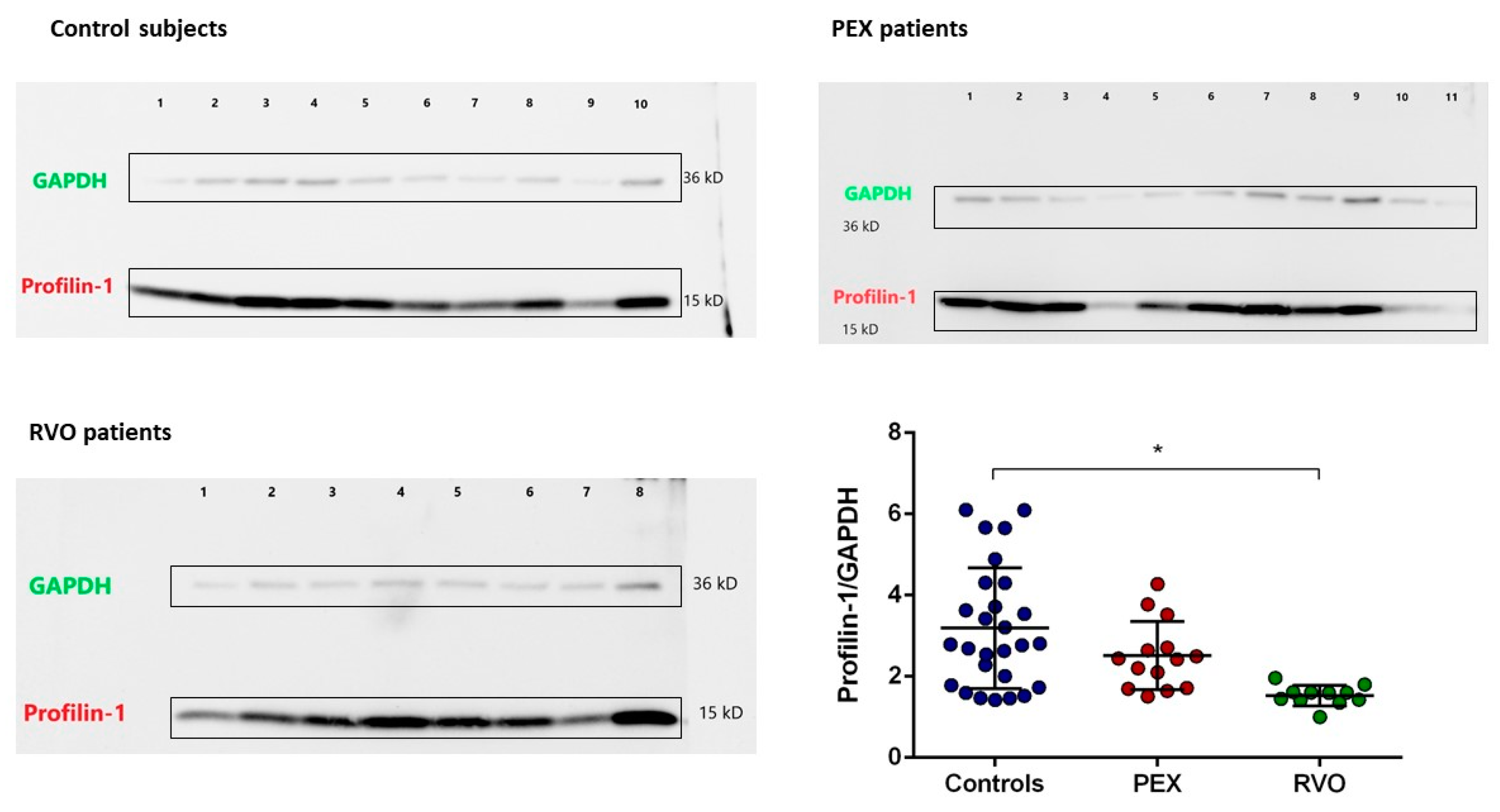 Ijms 25 01403 g006 Ijms 25 01403 g006