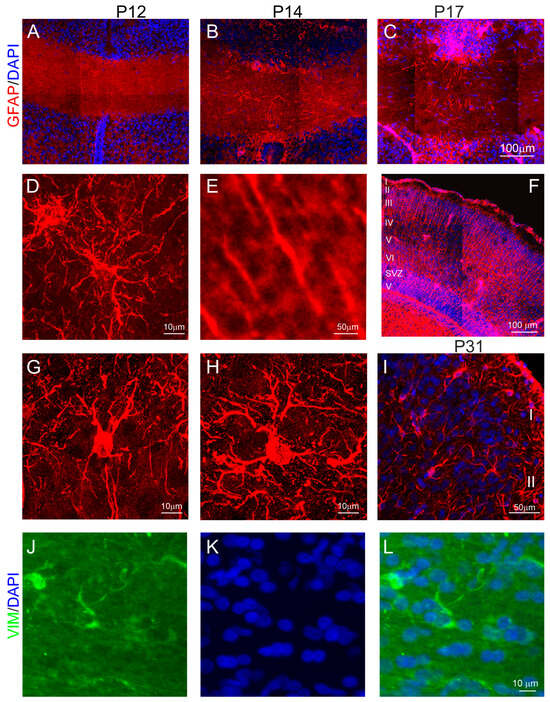 「good evening」 Astrocytes of the Anterior Commissure Regulate the Axon