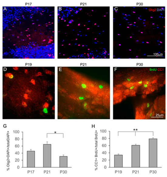 「good evening」 Astrocytes of the Anterior Commissure Regulate the Axon