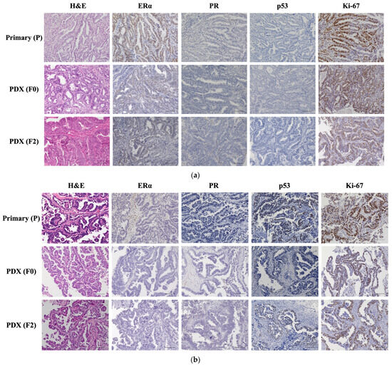 IJMS | Free Full-Text | Consistency Between Primary Uterine Corpus.