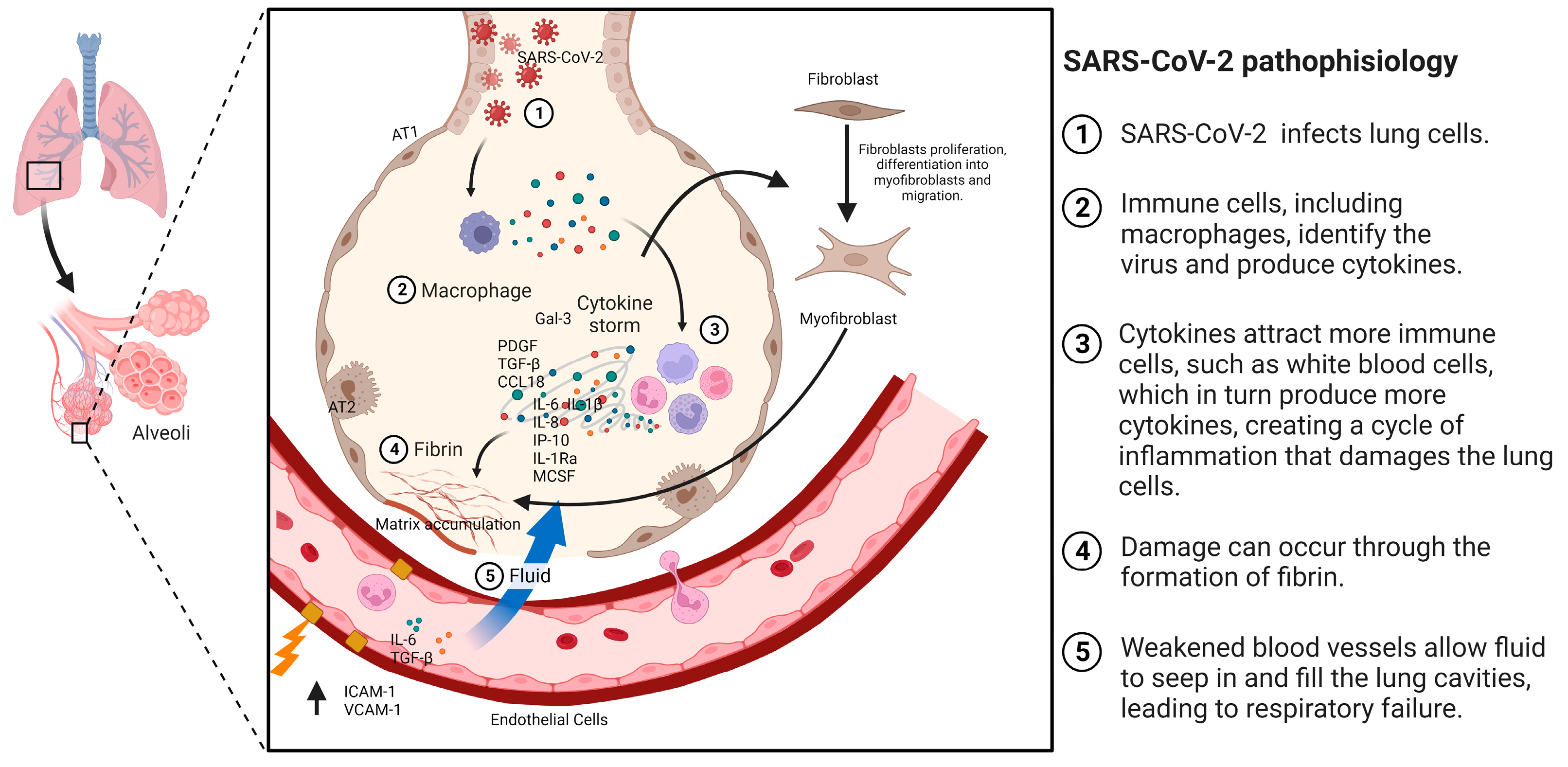 IJMS | Free Full-Text | Antifibrotic Drugs against Idiopathic Pulmonary ...