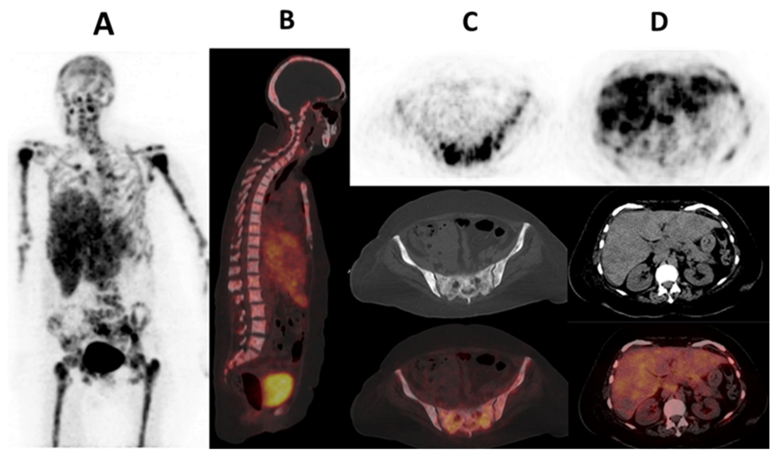 Ijms 25 01575 g004 Ijms 25 01575 g004