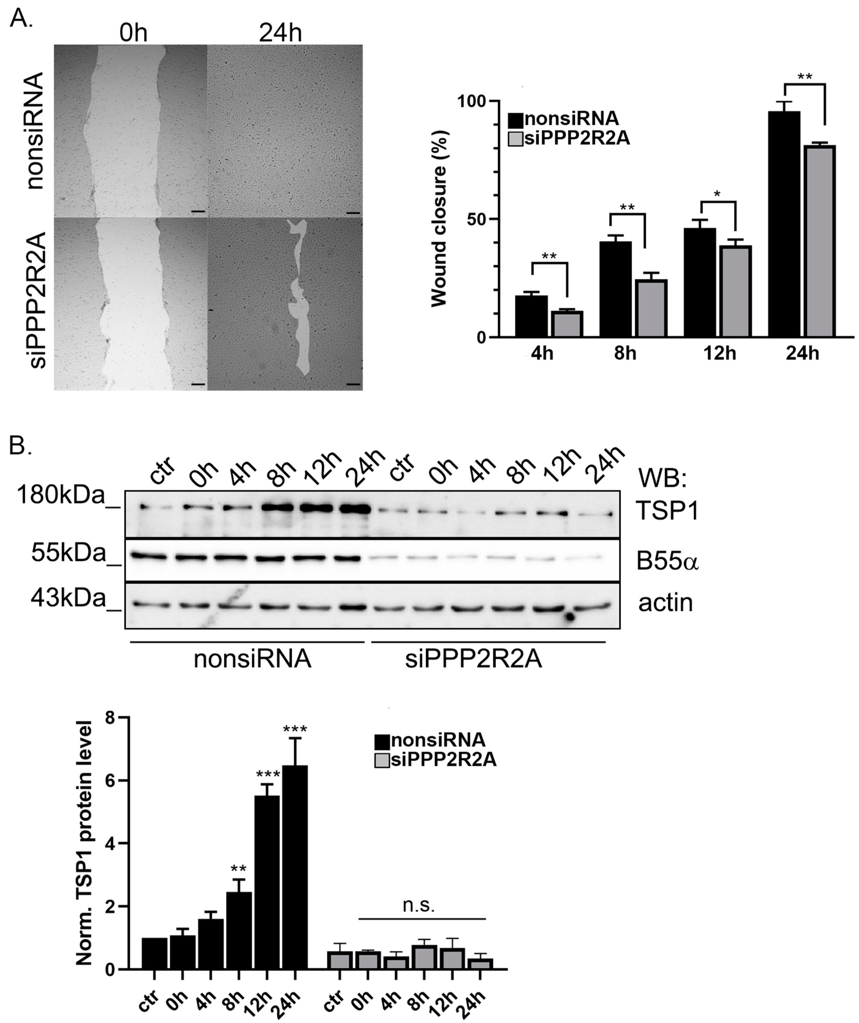 Ijms 25 01844 g006 Ijms 25 01844 g006