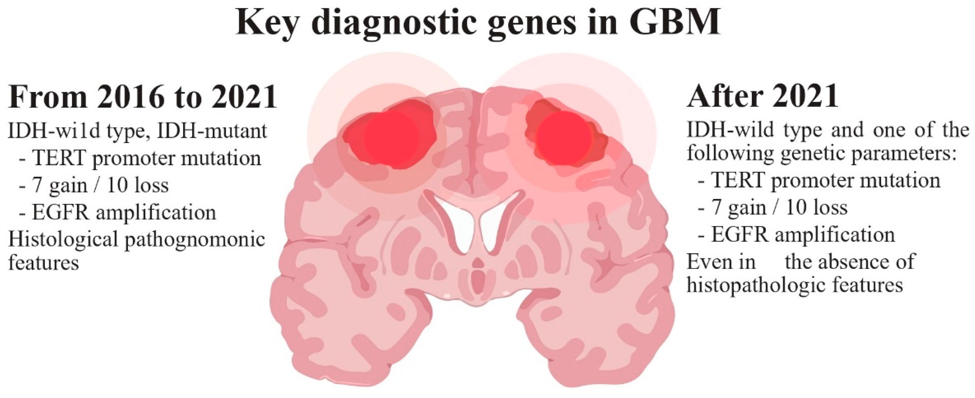 IJMS Free Full Text Glioblastoma Therapy Past Present and Future