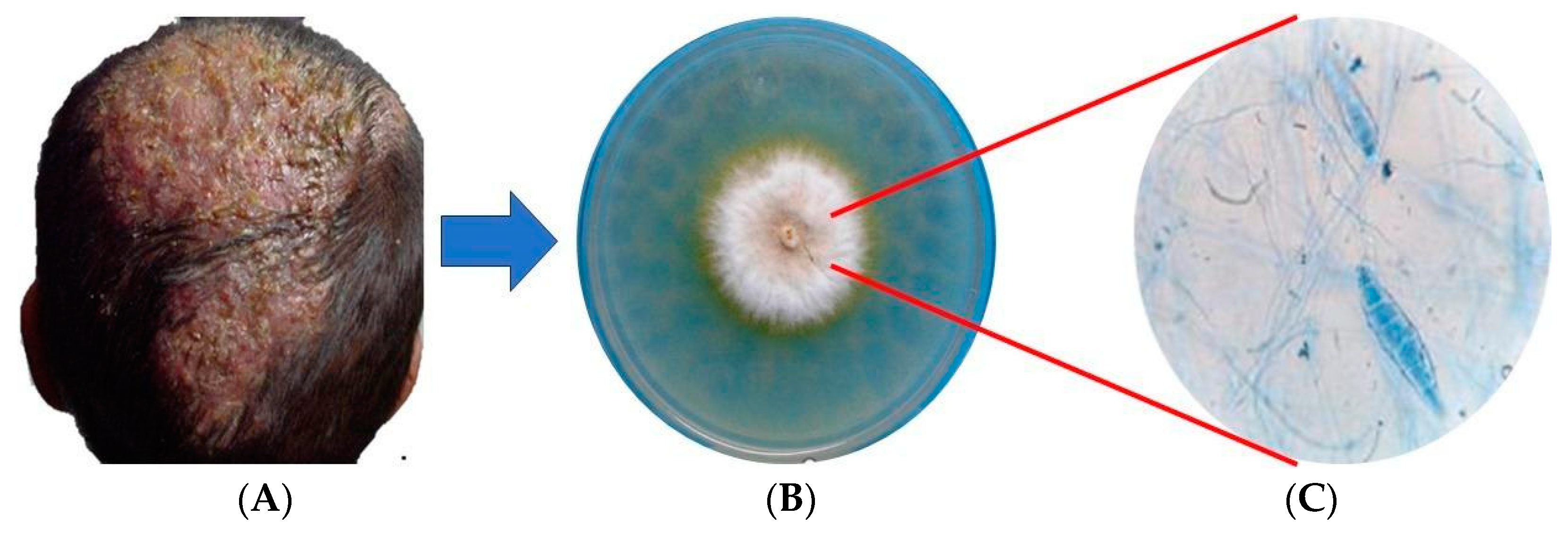 Ijms 25 02533 g001 Ijms 25 02533 g001