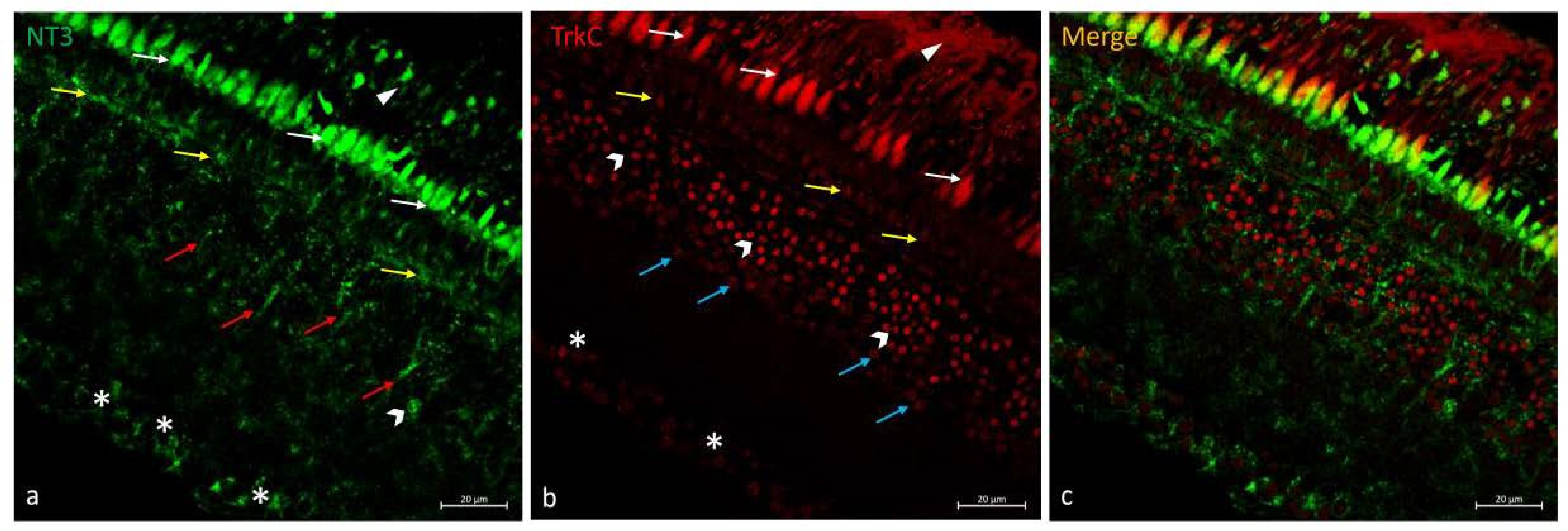 Ijms 25 02732 g005 Ijms 25 02732 g005