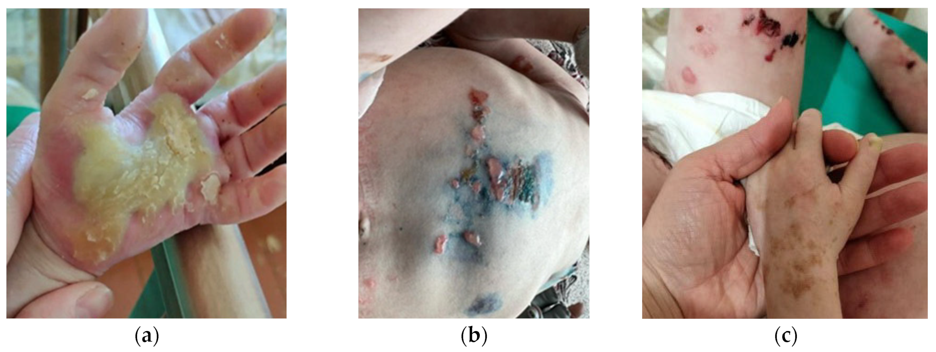 Ijms 25 02989 g001 Ijms 25 02989 g001