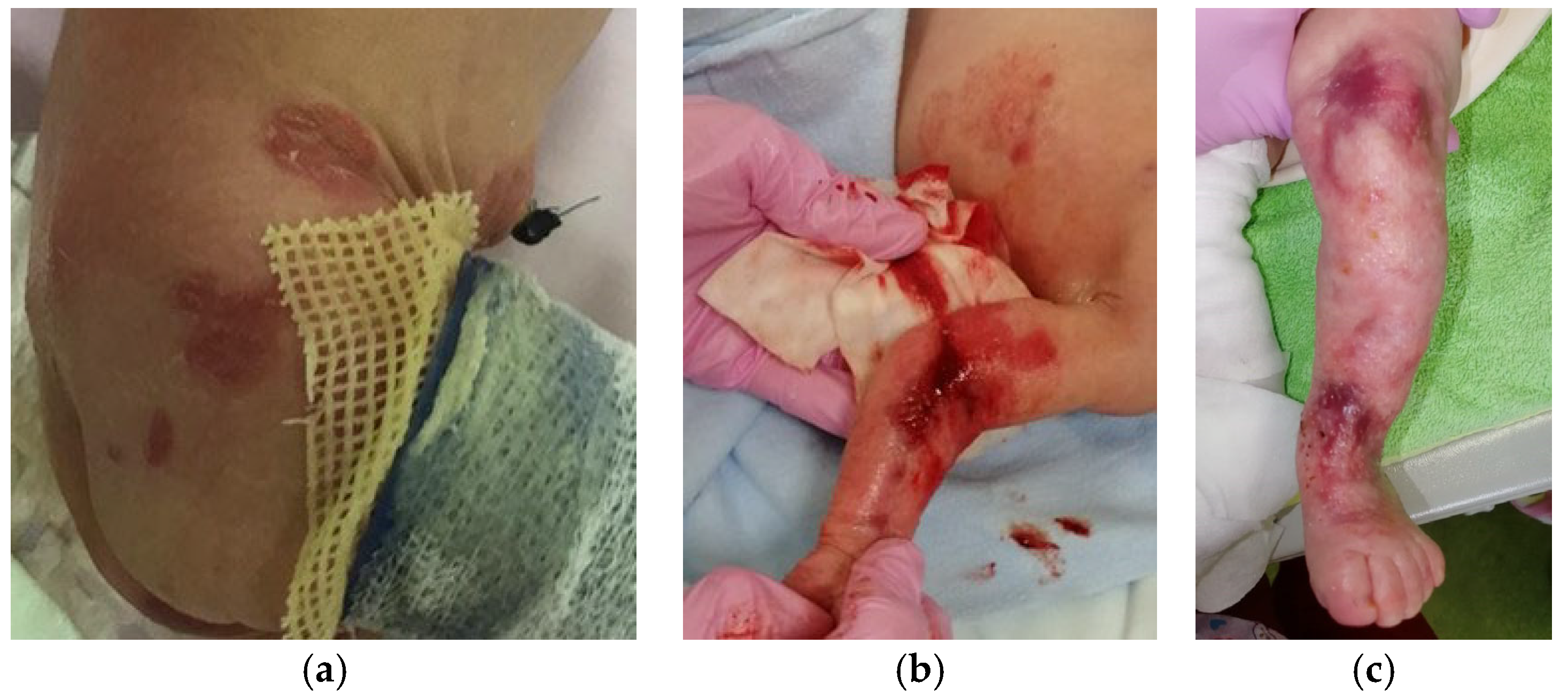 Ijms 25 02989 g004 Ijms 25 02989 g004