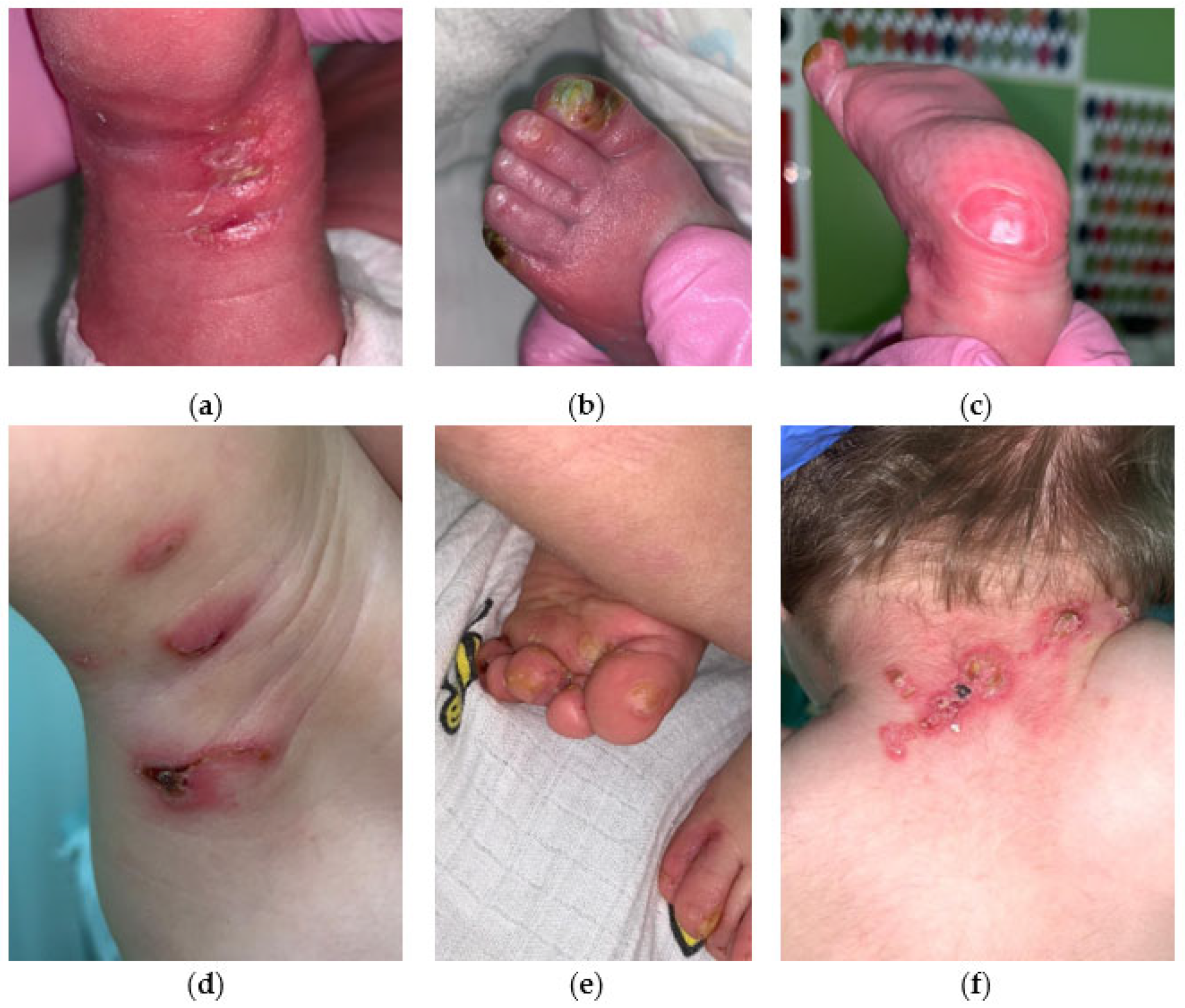 Ijms 25 02989 g005 Ijms 25 02989 g005