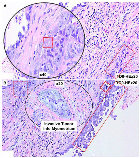 IJMS | Free Full-Text | Atlas of Tumor and Tumor Microenvironment Cells ...
