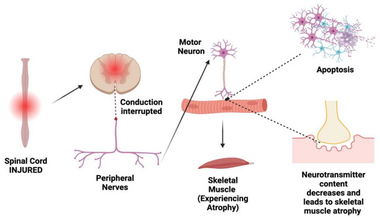 Muscle Diseases (神経学) Frontiers | LGMD D2 TNPO3-Related: From Clinical Spectrum to