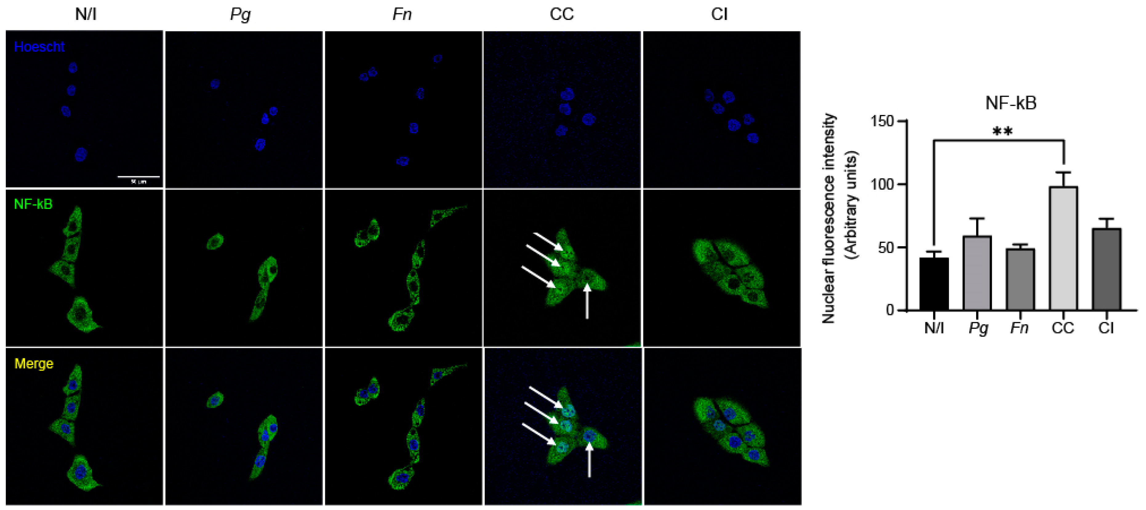 Ijms 25 03611 g004 Ijms 25 03611 g004