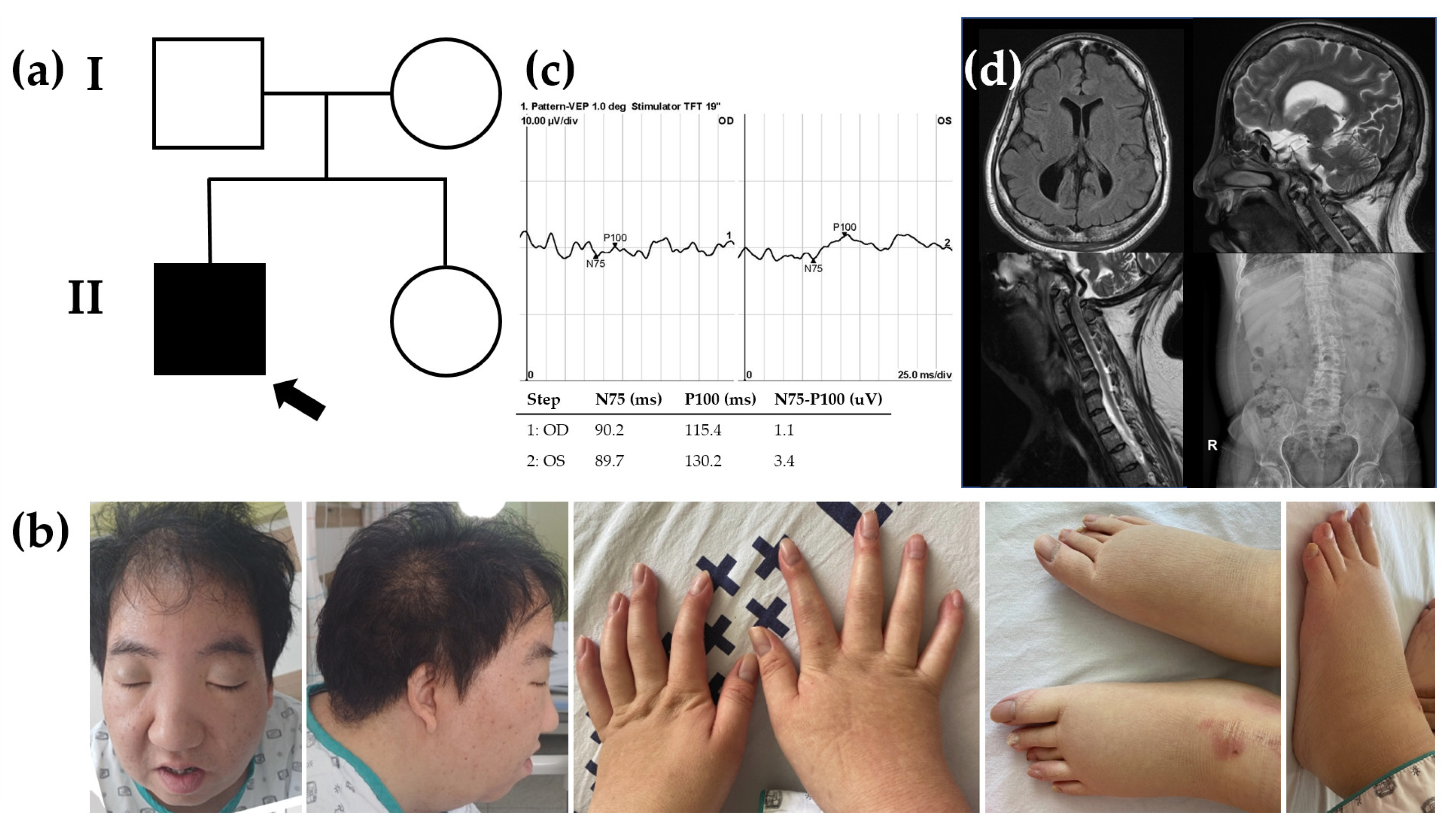 The First Korean Case with Cardiac, Facial, and Digital The First Korean Case with Cardiac, Facial, and Digital