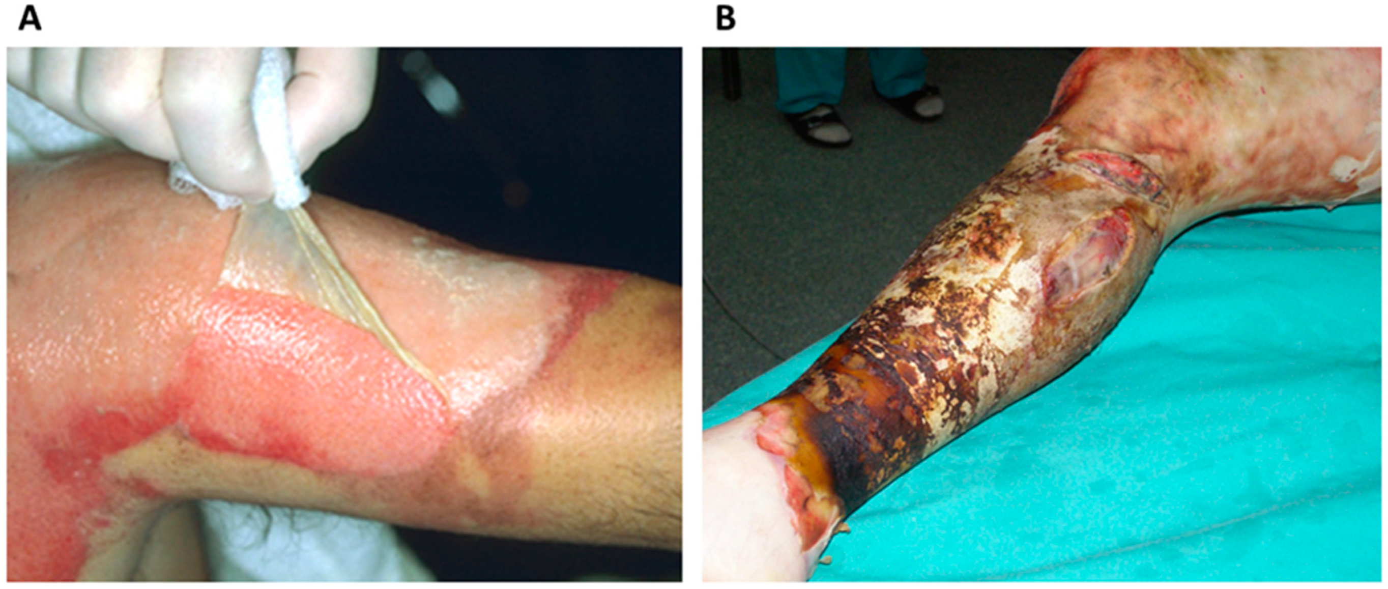 Ijms 25 03702 g001 Ijms 25 03702 g001