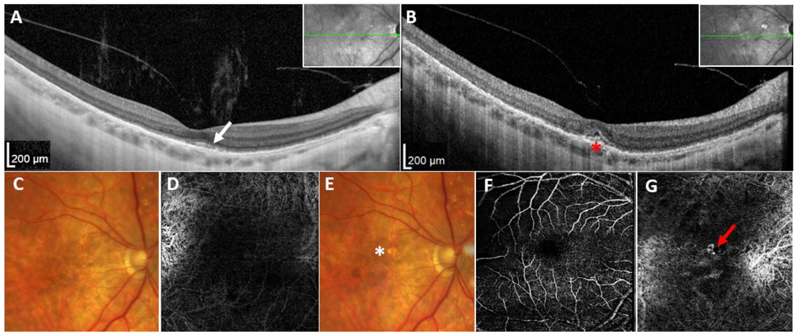 Ijms 25 03744 g002 Ijms 25 03744 g002