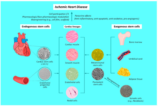 Stem Cell Therapy against Ischemic Heart Disease