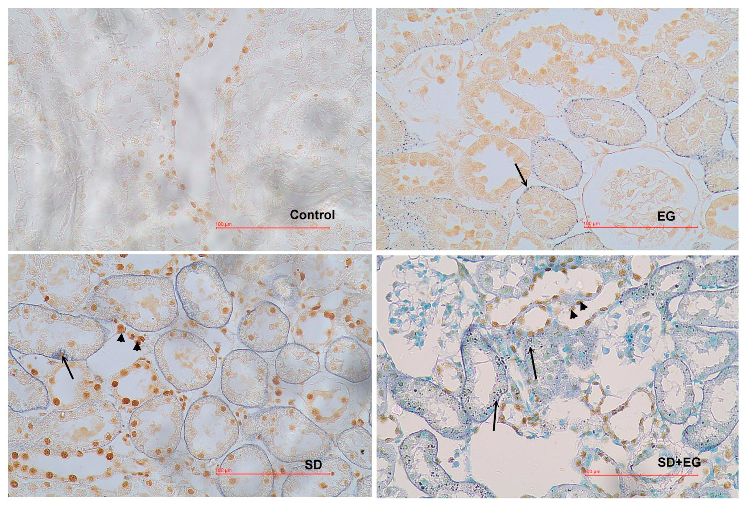 Ijms 25 03942 g005 Ijms 25 03942 g005