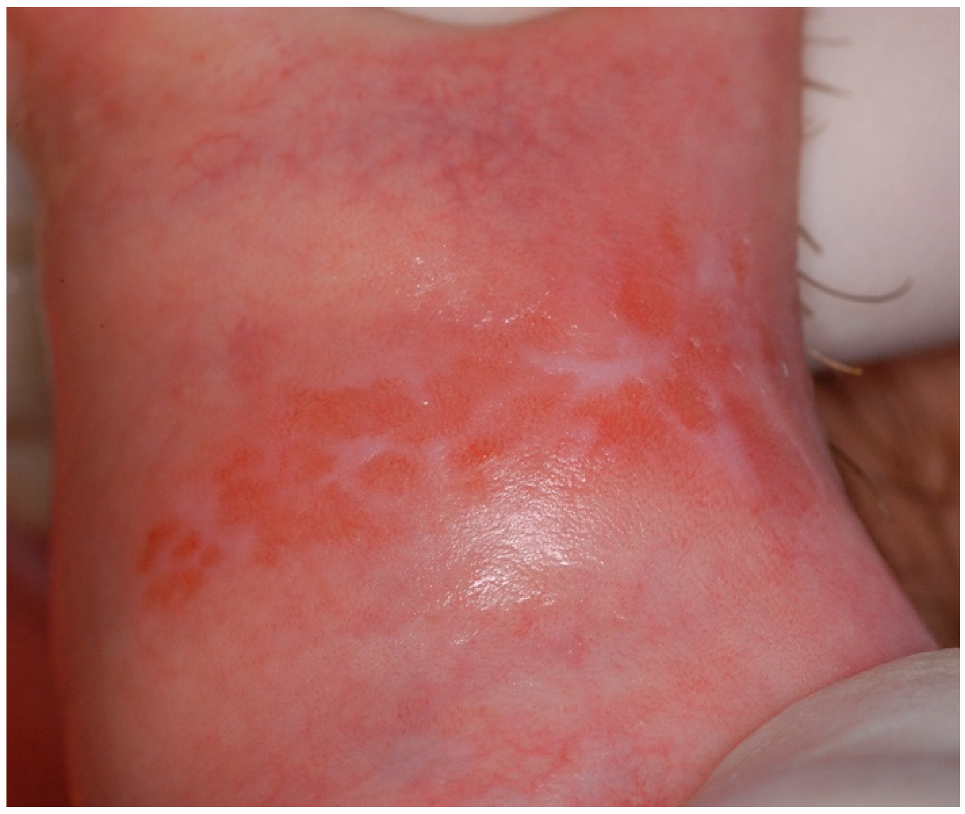 Ijms 25 04373 g004 Ijms 25 04373 g004